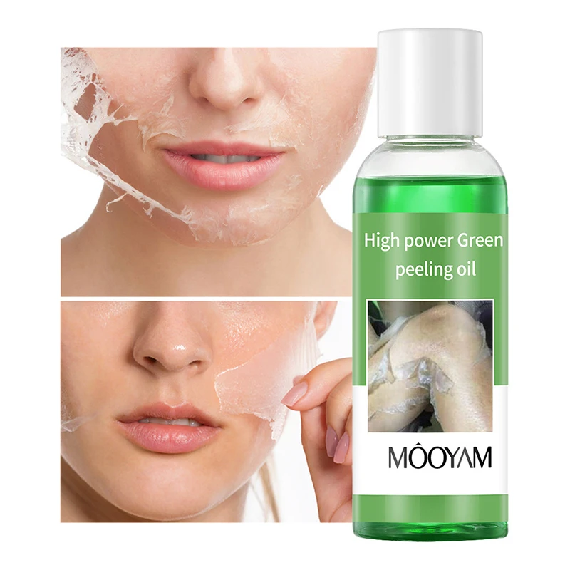 Salicylic Acid Peel-off Exfoliating Oil Removes Dead Skin From Face And Body Softens Cuticles Deeply Cleanses Without Irritation view 4