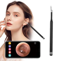 Smart Visual Ear Cleaner 5.5mm 3-in-1 Ear Otoscope Earwax Remover Picker USB C Charging Endoscope MIni Camera Health