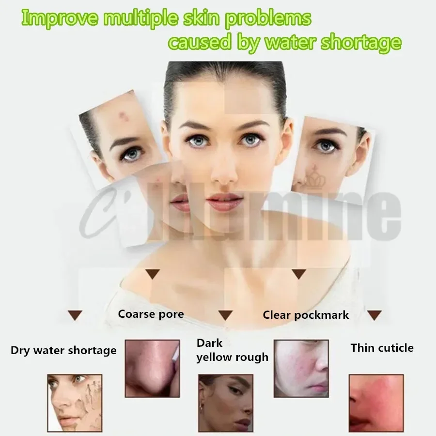 Nicotinamide Skin Lotion Moisturizing Replenishing Water Improve Dark Yellow Shrink age Pores OEM Cosmetics 100ml