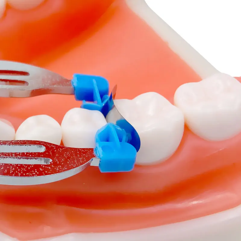 Bandes de matrices profilées sectionnelles dentaires, cales en métal No.1.398, outils de dentiste, boîte de 100 pièces