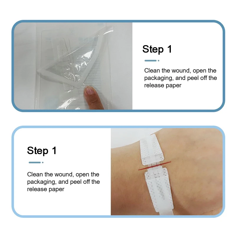 1Pc Zipper Tie Wound Closure Patch Zipper Band-Aid Wound Fast Suture Outdoor Portable Hemostatic Patch First Aid Tool