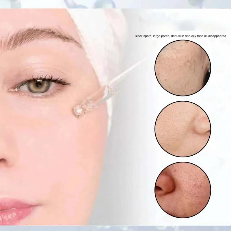 Suero facial de ácido salicílico con retinol y niacinamida Piel suave | Reducir los poros