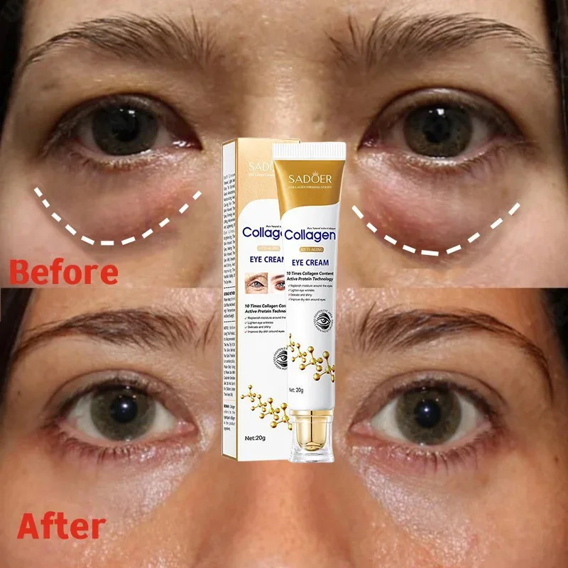 Crema de eliminación de bolsas de ojos instantáneas, eliminación de colágeno, arrugas, reafirmante, desvanecimiento de la piel, líneas finas, ilumina el círculo oscuro, antihinchazón, nuevo