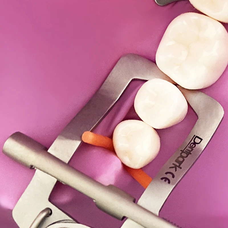 

Сепаратор зубных зубов из нержавеющей стали, фиксатор клина для передних и задних зубов цвета слоновой кости