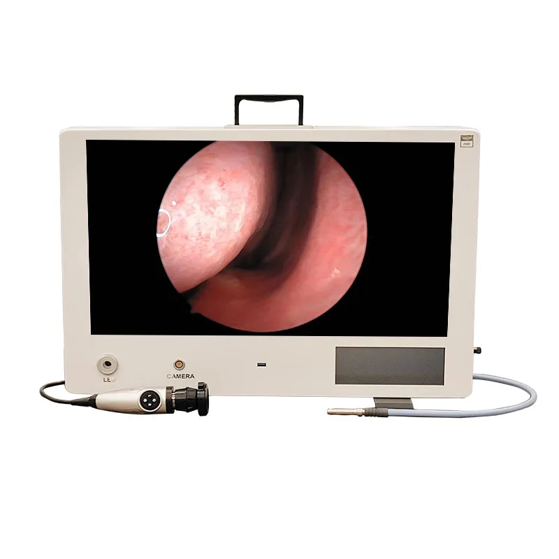 All-in-one motorized endoscopic   system with built-in display and video recorder for   procedures with