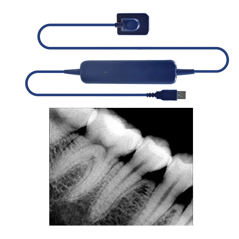 Dental Sensor With Holder Faster/Recycle/Durable USB Dental X Ray Sensor Intra Oral Camera Digital RVG Sensor