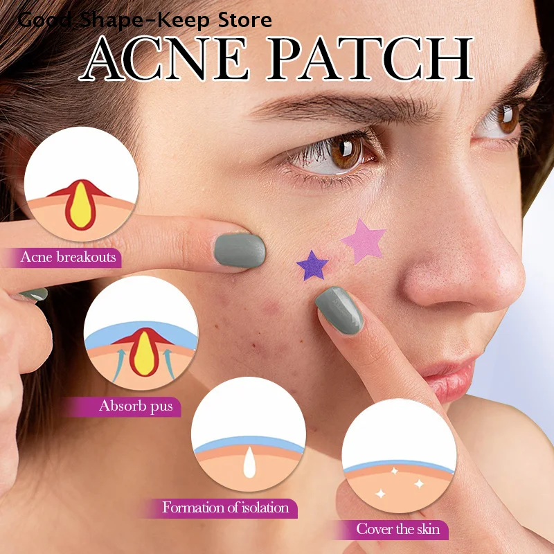 1Box 32 Patches Acne Patch Fade Four-color Concealer Makeup Tool Repair Invisible Acne Removal Stickers Star Style With Mirror