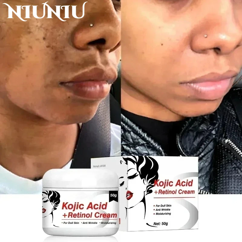 

Kojic Acid Retinol Cream Quickly Fade Melasma Cream Fade Fine Lines Brightening Moisturizing Skin Care Women Skin Brighten Cream