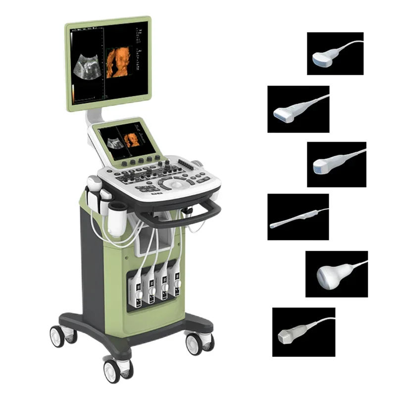 Zoncare Trolley 4D 5D Color Doppler System El sistema de Ultrasonido Doppler con carrito