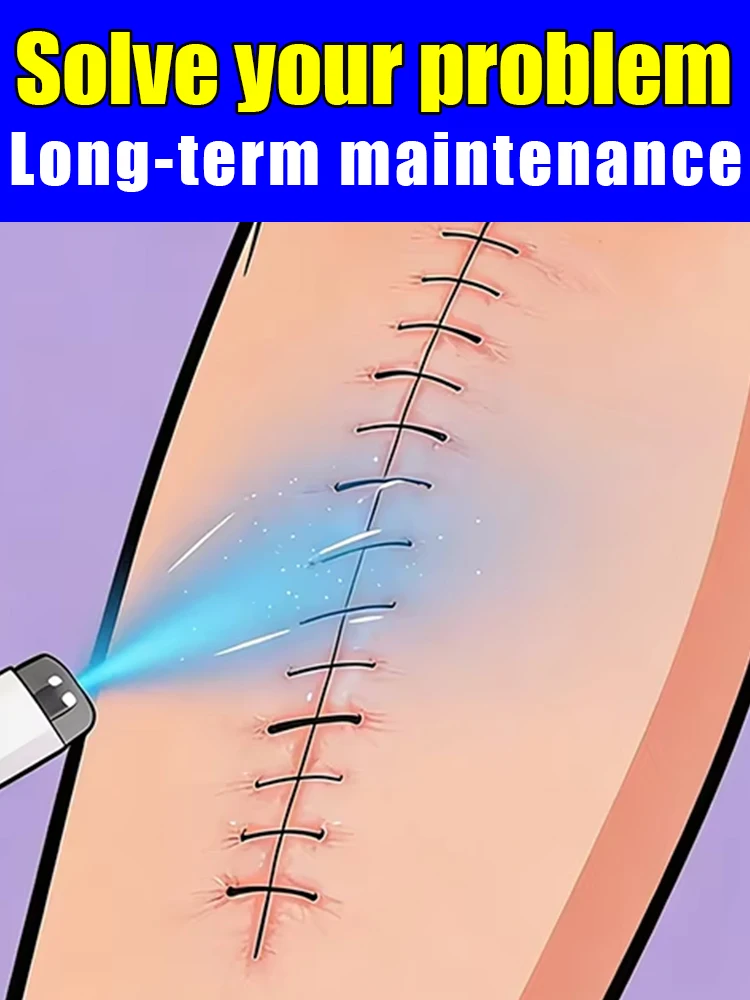 Popular Choice Blue light laser New product No ꜱᴄᴀʀ