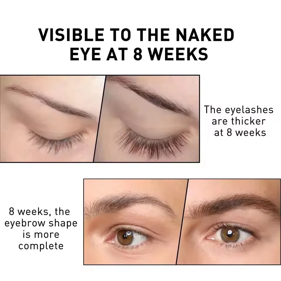 Wimpervoedende essentie Wimpervloeistof Snel, natuurlijk, dicht, zwart, krullend, slank en verhoogt de valse wimpers en wenkbrauwen