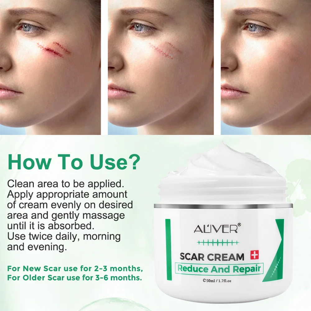 ALVER Acne Scar Stretch Marks Remover Cream Skin Repair Acne Black Dots Spots Acne Treatment Blackhead Bleaching Cream 50ml