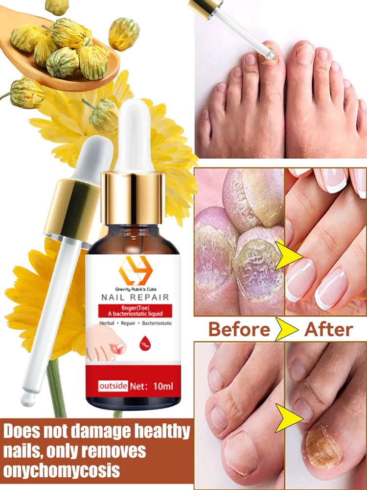 Restore your nails to their perfect moment