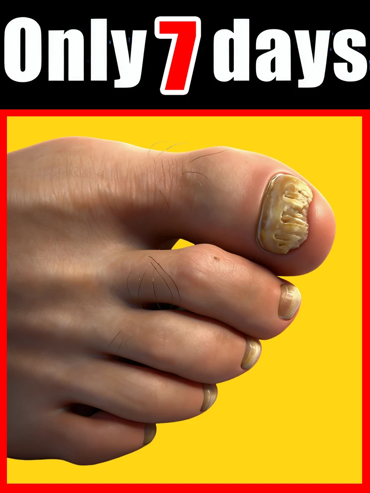 

Комбинированный набор обновленной версии, бесплатная доставка, омоложение — технология предотвращения грибка — регулируемый датчик управления и безопасности, унисекс