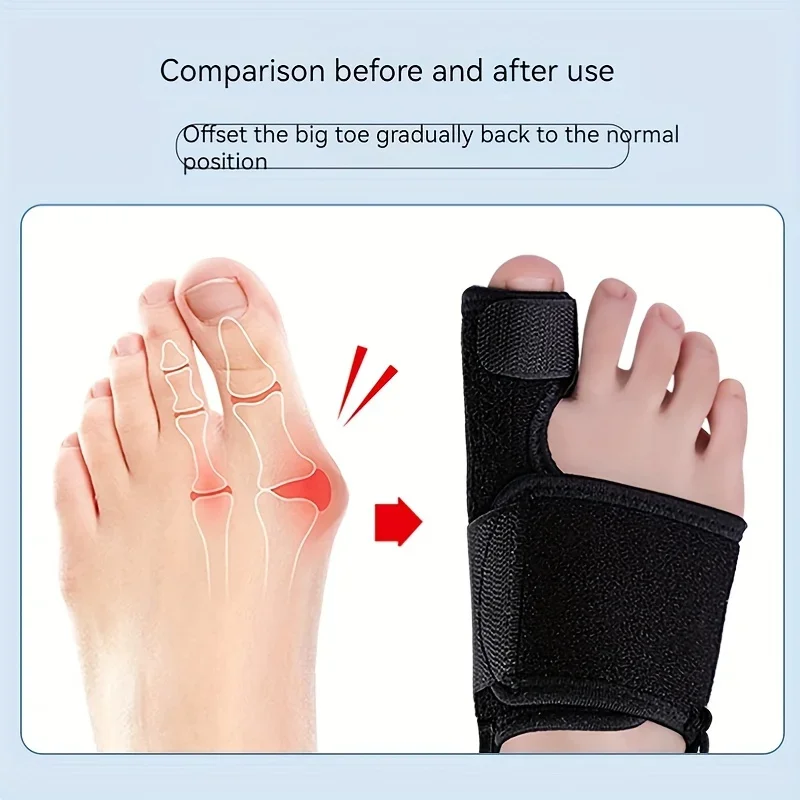 Toe Thumb Valgus Orthopedic Band Adjustable Spring Support Correction Belt Foot Strap Protectors Fixed Sport Safety