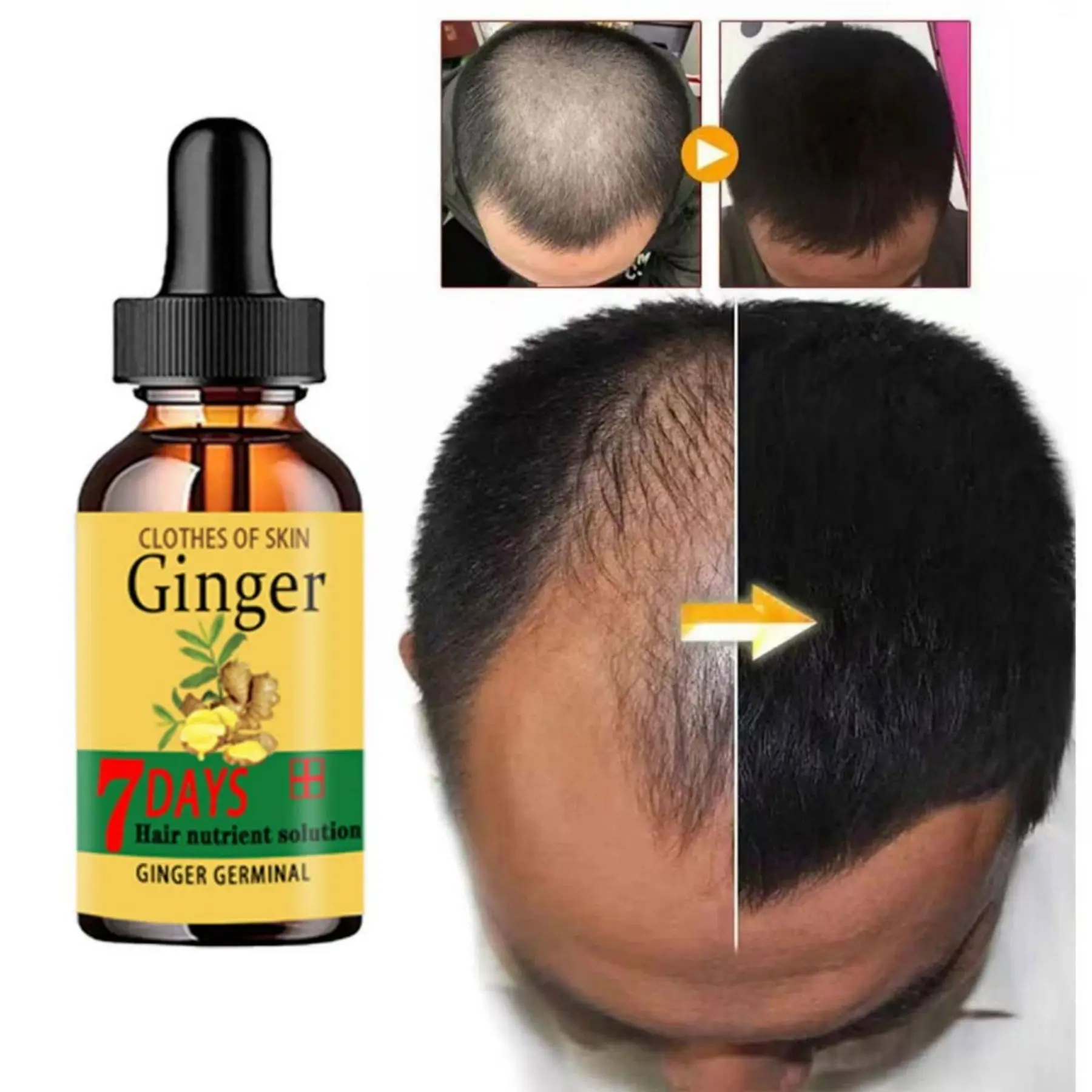 Aceite de esencia de crecimiento del cabello de jengibre, suero para el crecimiento del cabello, Spray Anti pérdida de cabello, tratamiento pampakapal ng buhok