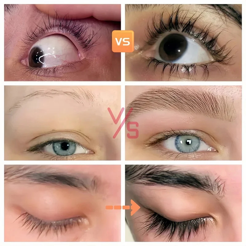 Soro de crescimento rápido de cílios, 5 dias, intensificador de cílios naturais, tratamento de cílios mais grossos, novos produtos, cuidados com os olhos, maquiagem