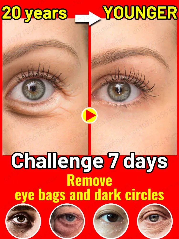 Hot Anti-Wrinkle Eye Cream Dark Circles Remove Eye Bags Puffy Eyes Reduce Wrinkles Fine Lines Remover Eye