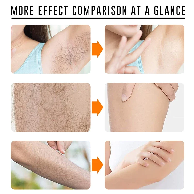 Permanent Hair Removal Spray Painless Armpit Legs Arms Hair Remover Hair Growth Inhibitor Depilatory Nourishing Repair Body Care