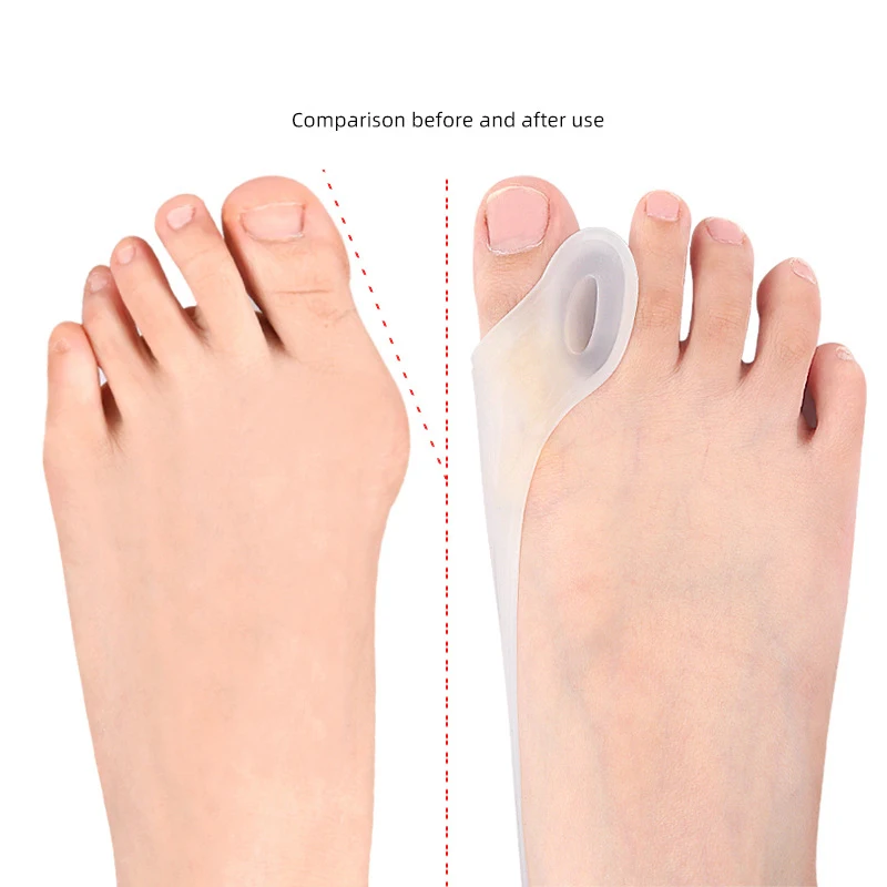 1PCS Silicone Gel Thumb Corrector Bunion Foot Toe Hallux Valgus Protector Separator Finger Straightener Adjuster Foot Care Tool