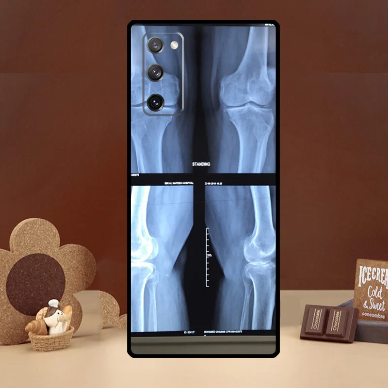 X-ray Hand Bones Silicone Case For Samsung Galaxy S8 S9 S10 S20 FE S21 Plus Note 20 Ultra S22 Ultra Cover