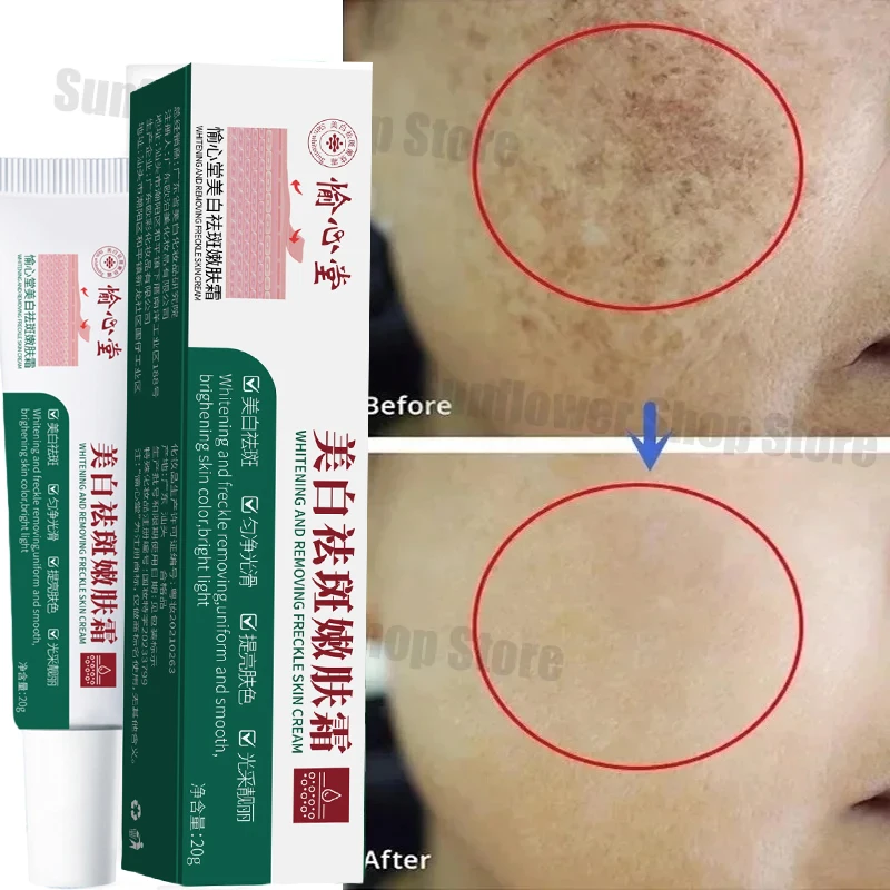 Effective Whitening Freckle Cream Remove Dark Spot Cream Removal Melanin Melasma Lighten Brighten Anti-Aging Skin Care Products