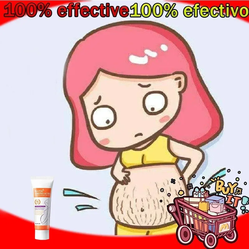 

7-Day Pregnancy Stretch Mark Removal Postpartum Obesity Scar-Free Body Cream for Tightening and Lifting the Buttocks
