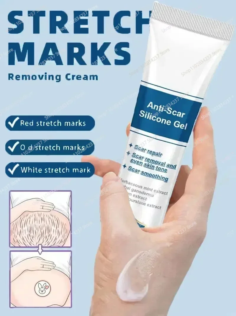 Old Stretch Marks Creme para Mulheres Grávidas, Eliminar Vermelho e Branco