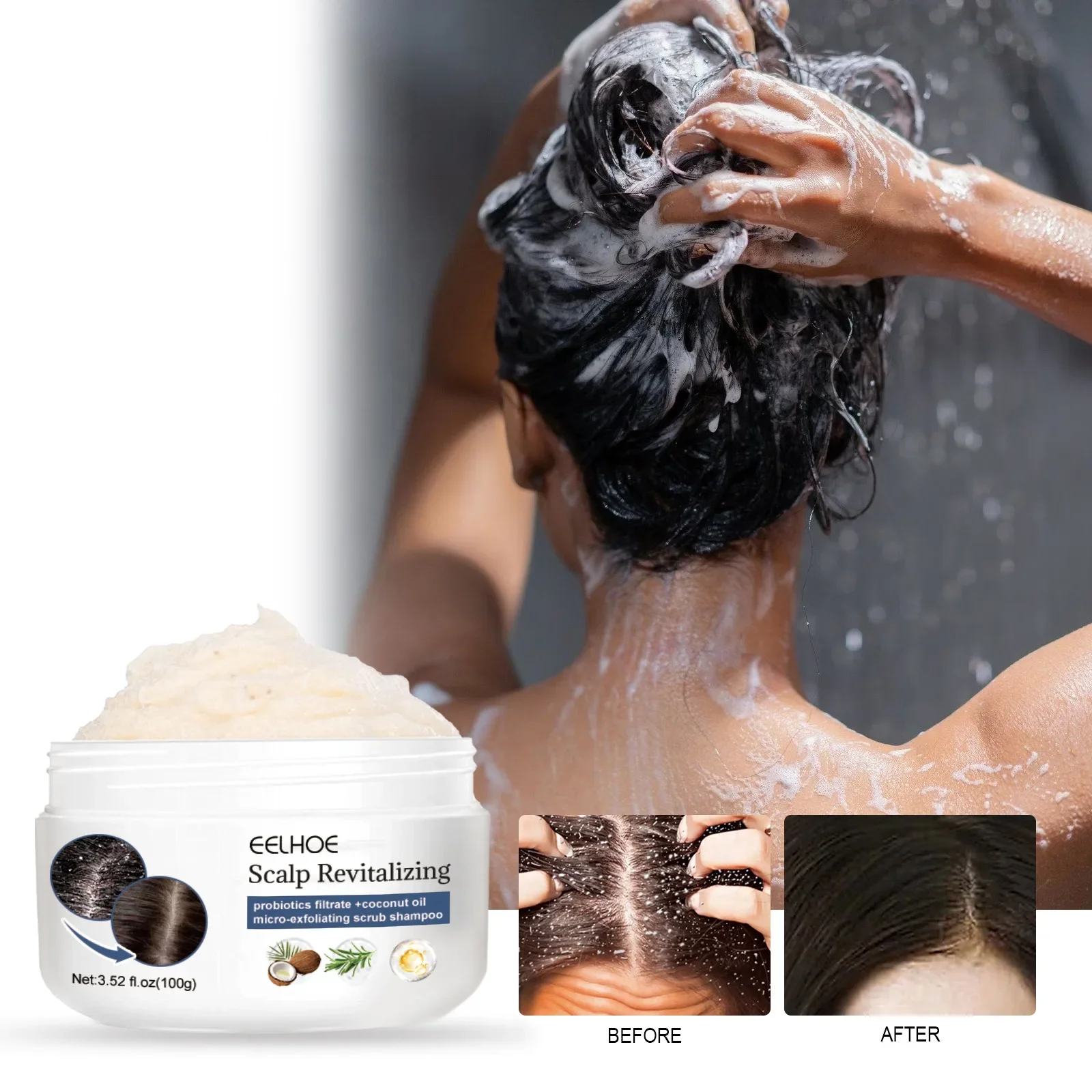 

Scalp Exfoliating Scrub Moisturizes Dry Hair Care Refreshing Scrub Cleanses Scalp Refreshing Scalp To Remove Hair Oils