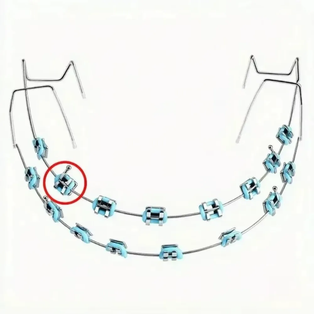 Fashion Braces Colorful 1 Pair Quality Temporary Tooth Decoration with Metal Wires Metal Bracket Orthodontic Ligature Ties High