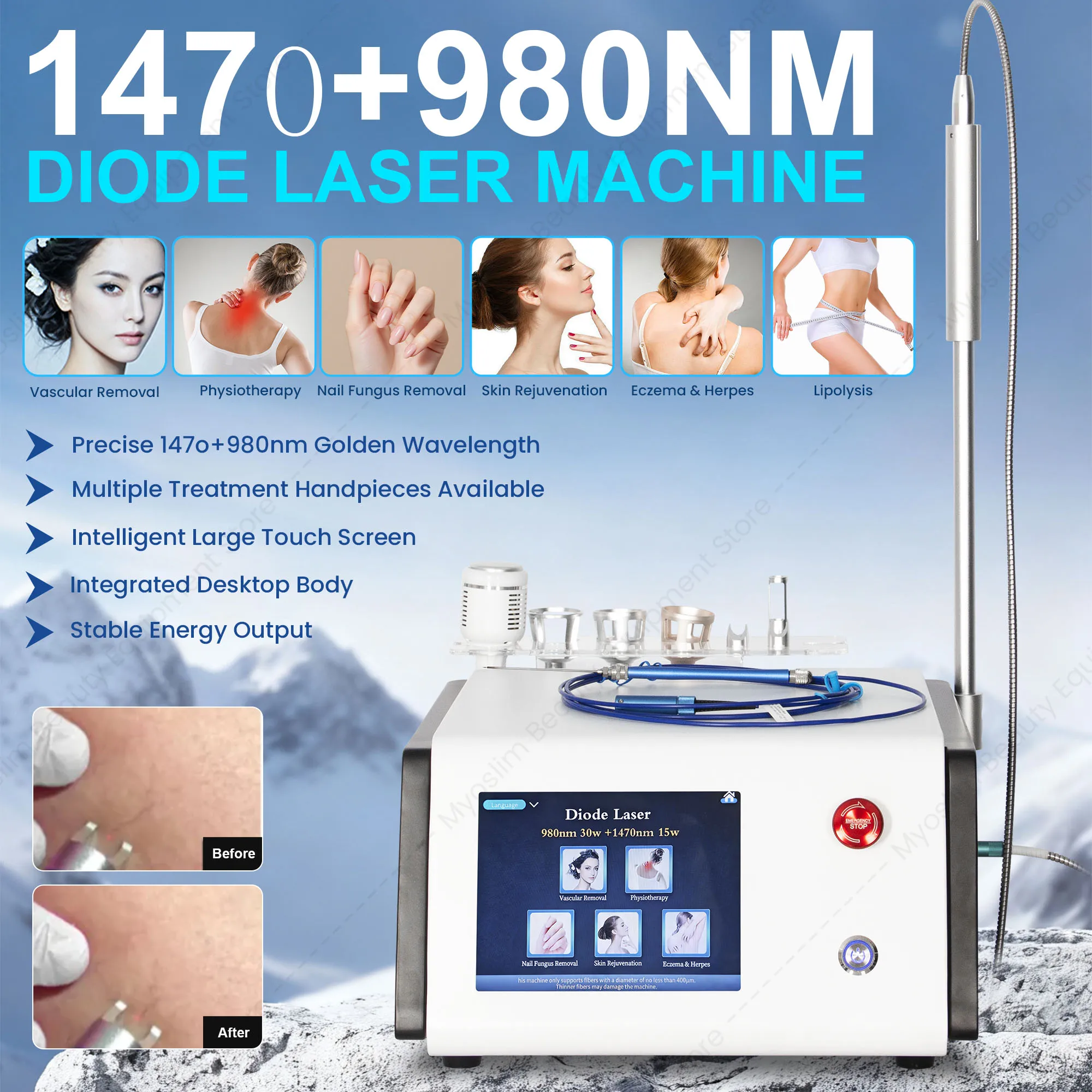 Professional 980nm 1470nm Dual Wavelength 6 in 1 Diode Beauty Device Skin Firming Body Contouring Nail Care Redness Care Machine