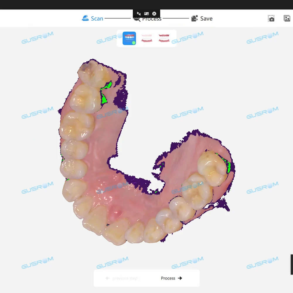 Gusrom GScan IQ ماسح ضوئي للأسنان داخل الفم عالي الدقة AI مسح سريع ثلاثي الأبعاد نظام مفتوح جهاز الانطباع الرقمي STL تصدير #2