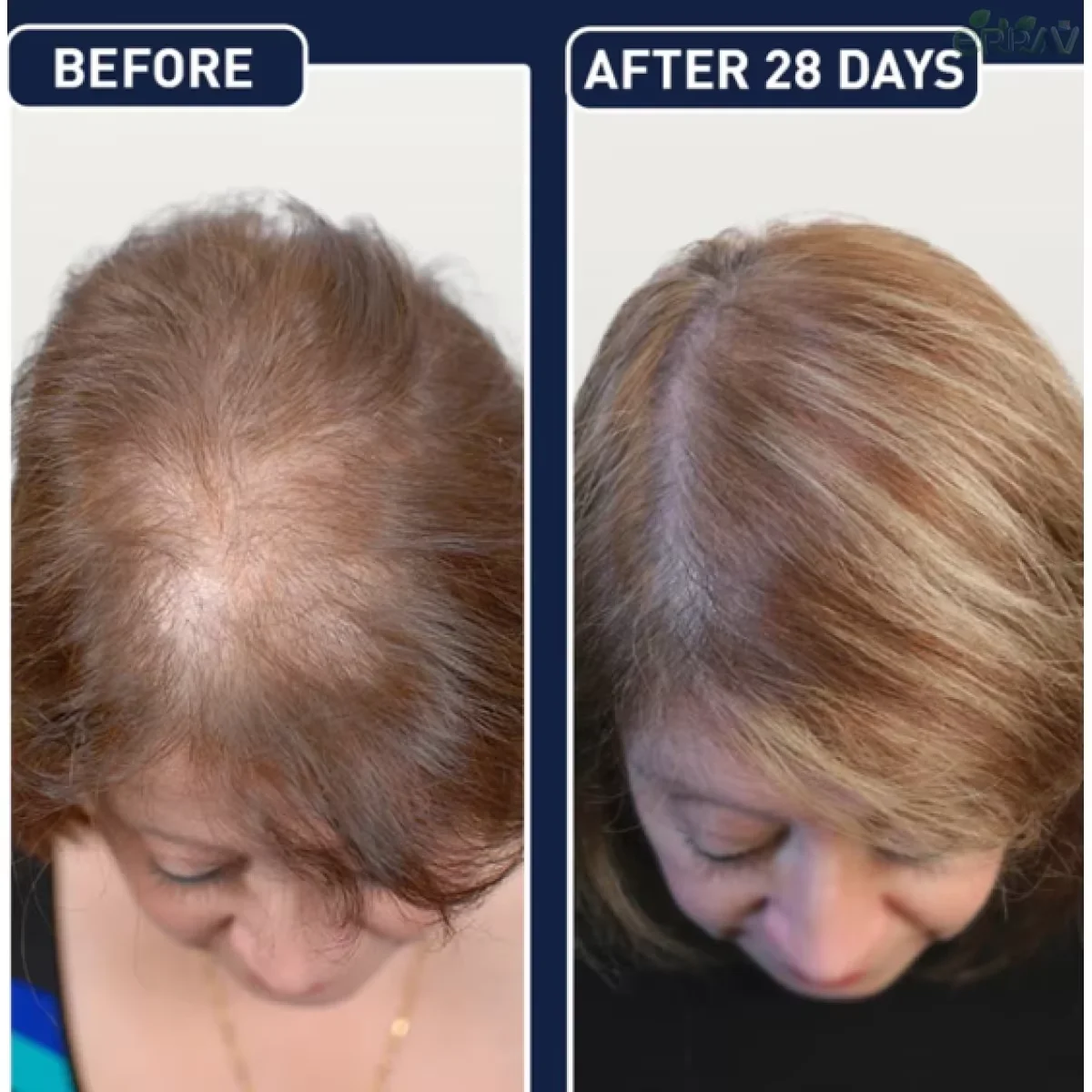 FEG Hair Sary - 50 مل اختيار سحري لتغذية الشعر، زجاجة رذاذ سهلة الحمل لتغذية محلول مغذي للشعر #5