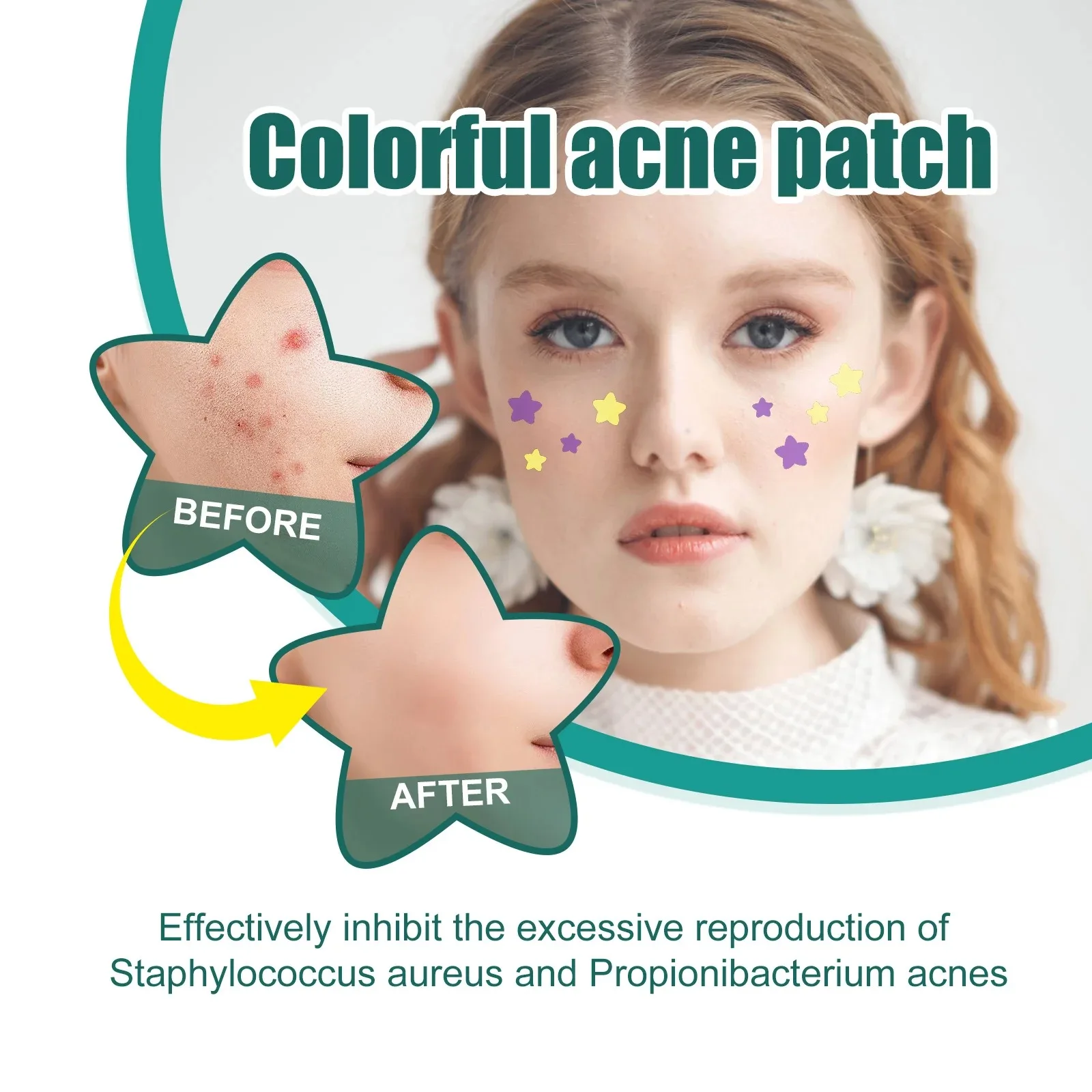 1/2/3 Box Star Acne Patches Invisible Pimple Cover Face Oil Control Spot Treatment Cute Sticker for Covering Zits and Blemishes