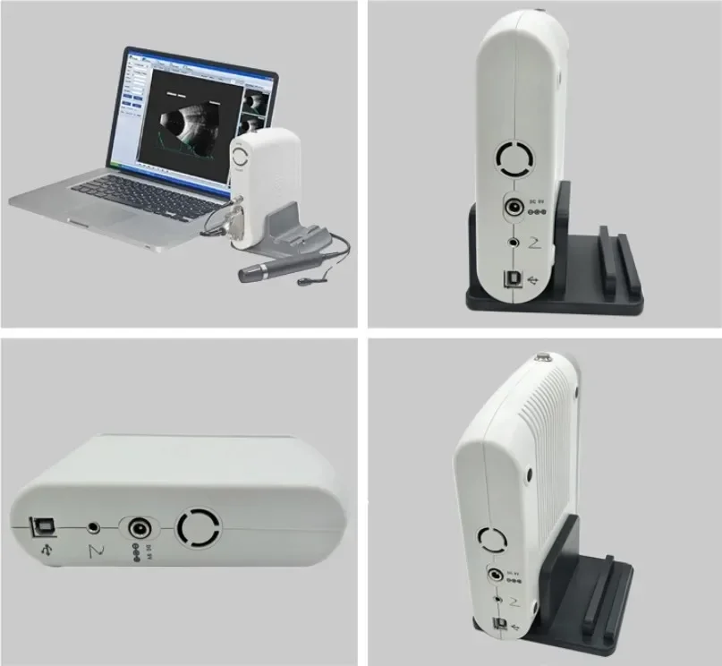 أداة طب العيون المحمولة من Holyavision، اختبار العين بالموجات فوق الصوتية، مسح AB #2