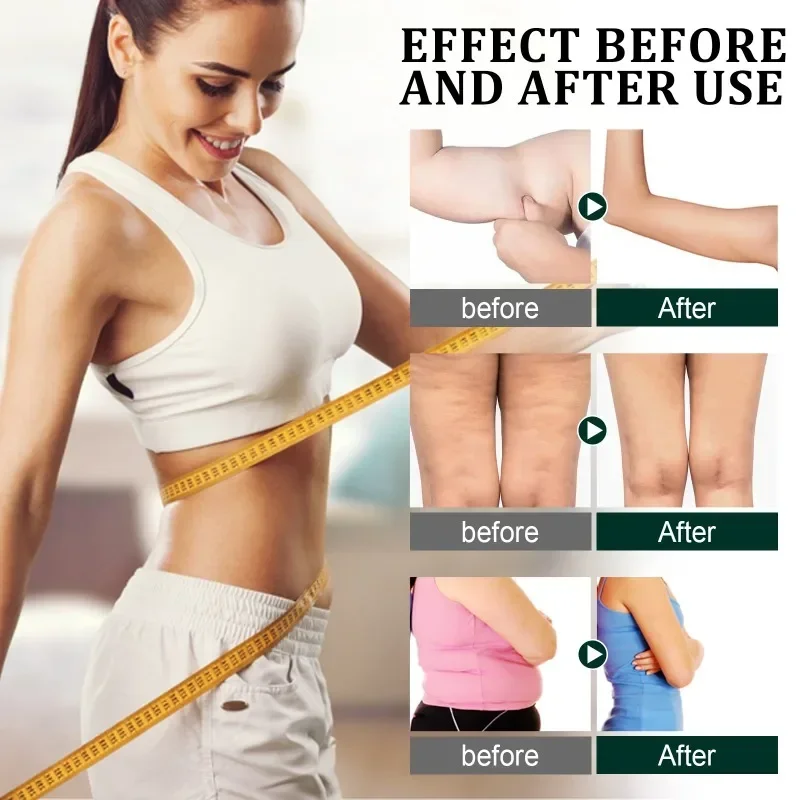 Slimming Essence Oil Fat Burning Belly Loss Fat Lose Weight Slim Down tighten abdominal thigh Weight Lose Schap Essential Oils