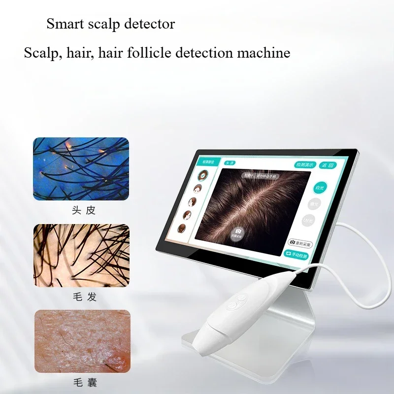 yyhc AI intelligent cloud scalp detector Hair follicle hair trispectral cloud storage hair store special detector