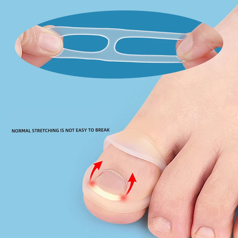 1Pcs Silicone Ingrown Toenail Correction Invisible Ingrown Toe Finger Nail Straightening Protector Brace Pedicure Feet Care Tool