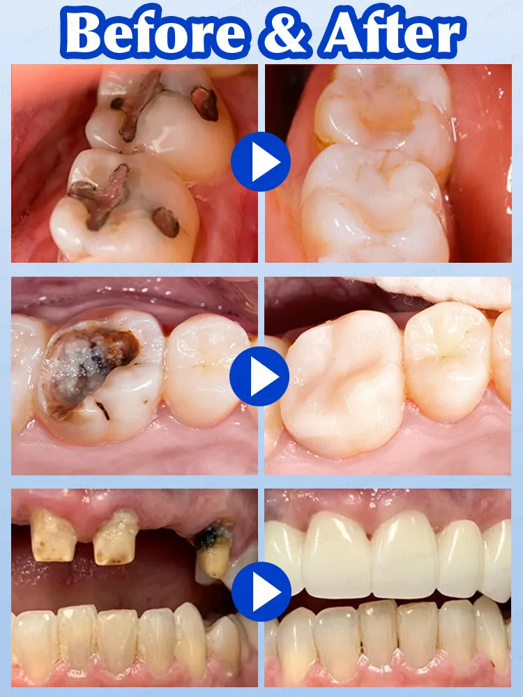 Repare a cárie dentária, remova a placa bacteriana e a periodontite. Branquear os dentes e eliminar o mau hálito