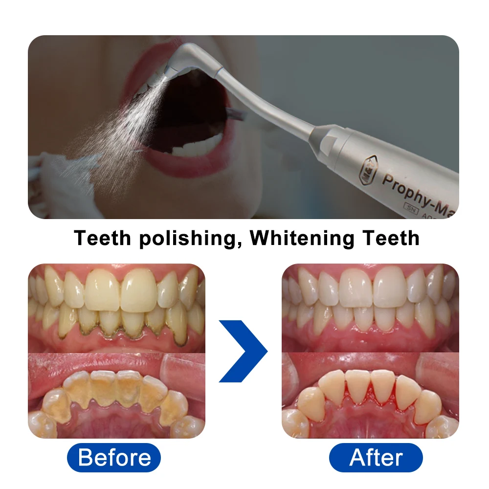 High Quality Dental Air Flow Teeth Polishing Polisher Handpiece Hygiene Prophy Jet PTL quick connect Dentistry Tools