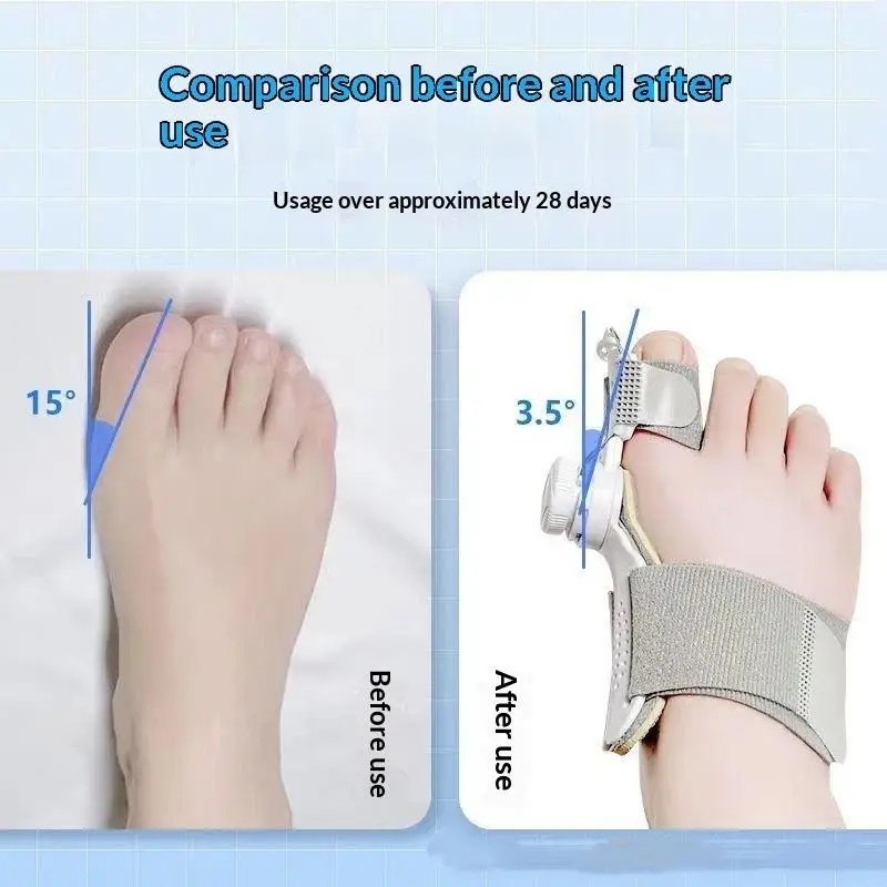 1 Stück verstellbarer Hallux-Valgus-Korrektor mit drehbarer Schnalle, Zehenspreizer, weicher und bequemer Hallux-Valgus-Deformationskorrektor, Fußpflege-Werkzeug. – Detail 7