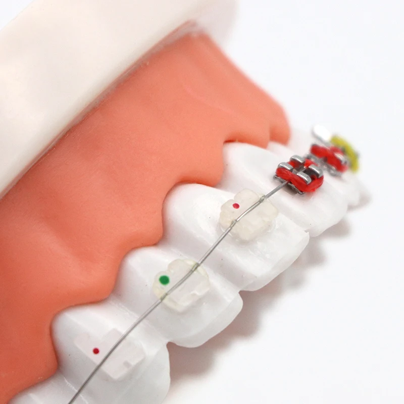 1szt Stomatologiczny model ortodontyczny Półmetalowe półramkowe aparaty ortodontyczne Leczenie zębów Standardowy model dydaktyczny Model zębów