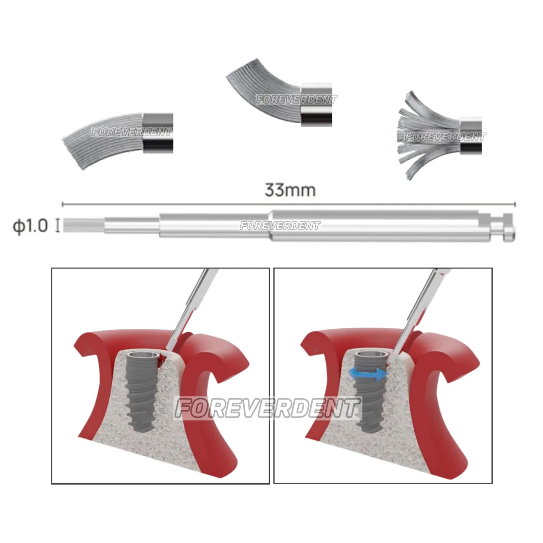 

1Piece Dental Fixture Surface Threads Cleaning Brush Titanium 1.0 Brushes Debridement