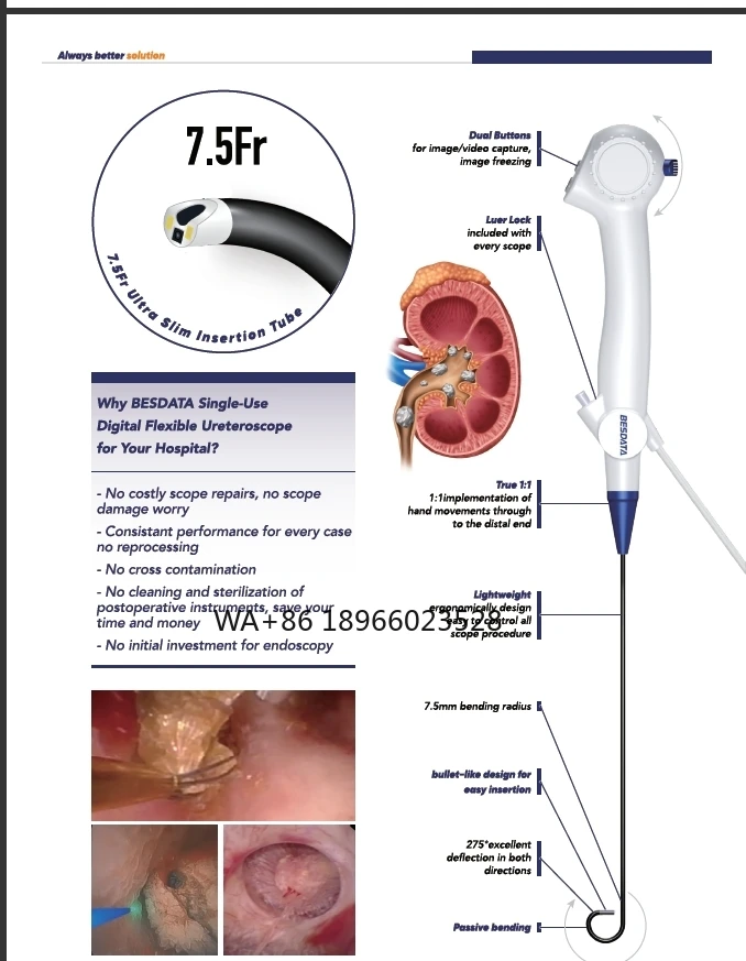 

7.5Fr disposable ureteroscope