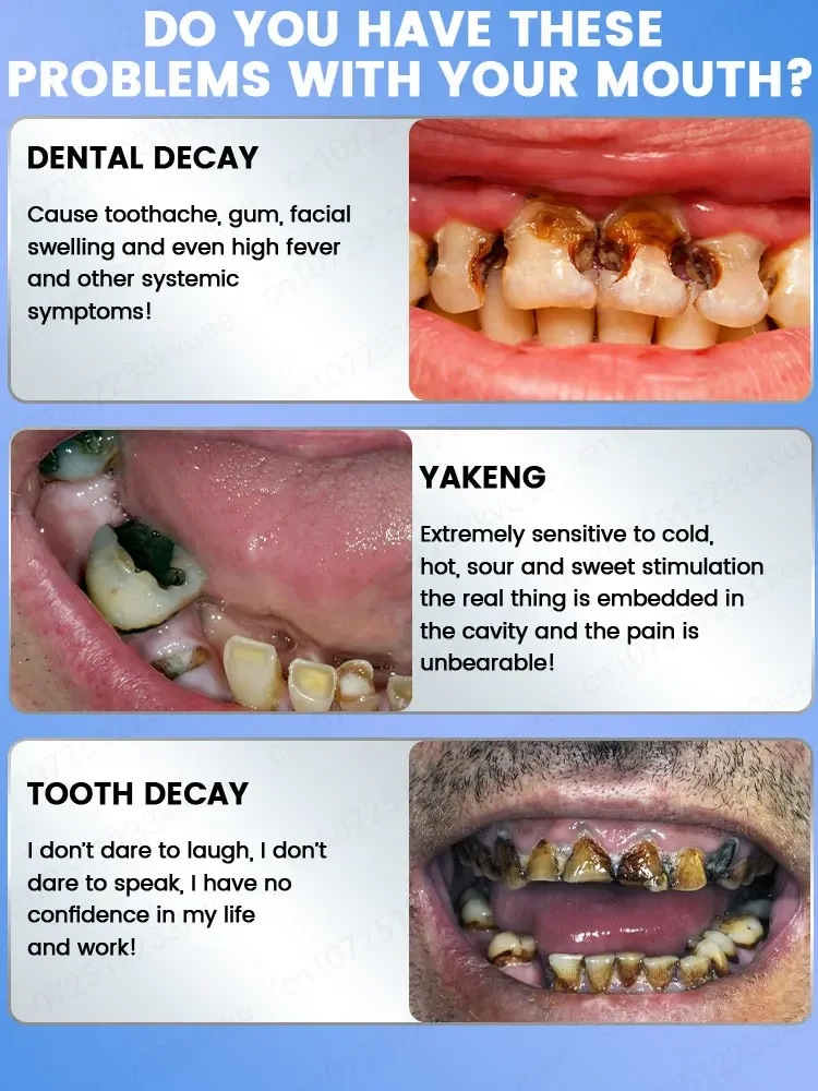 Repair tooth decay, remove plaque and periodontitis.