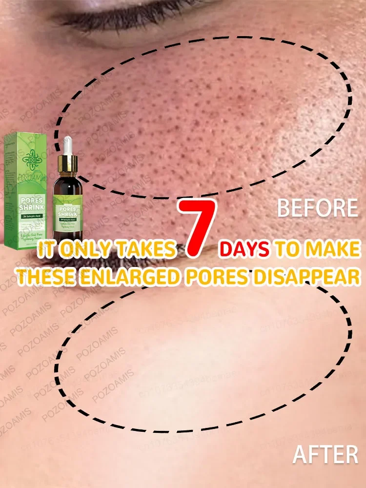 Get rid of large pores