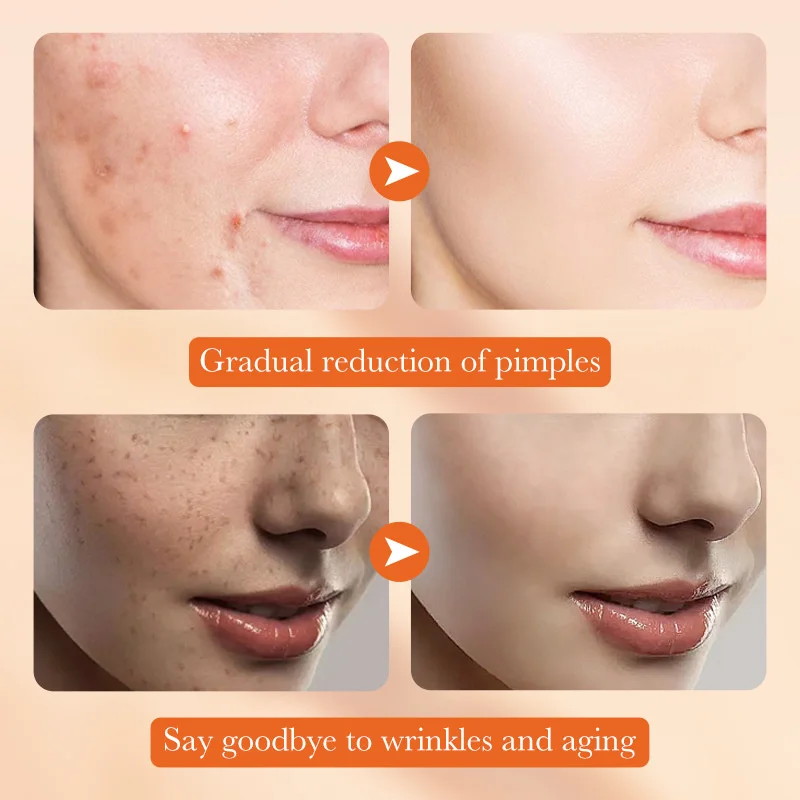 مقشر مرطب يزيل الجلد الميت ويعزز الترطيب ويصلح حاجز الجلد #3