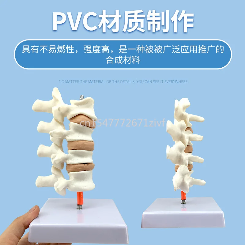 Human Femoral Osteoporosis Lesion Lumbar Anatomy Model Leg Bone Anatomy Spine Section Specimen