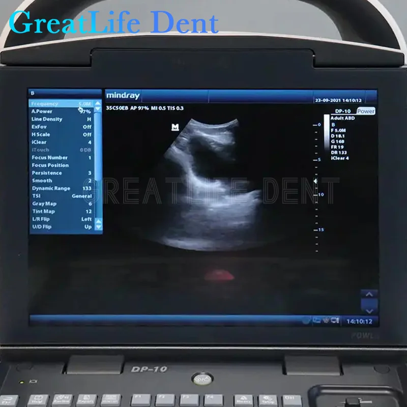 GreatLife Dent Mindray DP-10 Black and White Portable B-ultrasound Therapy Scanner Machine Abdominal Probe 35C50EB