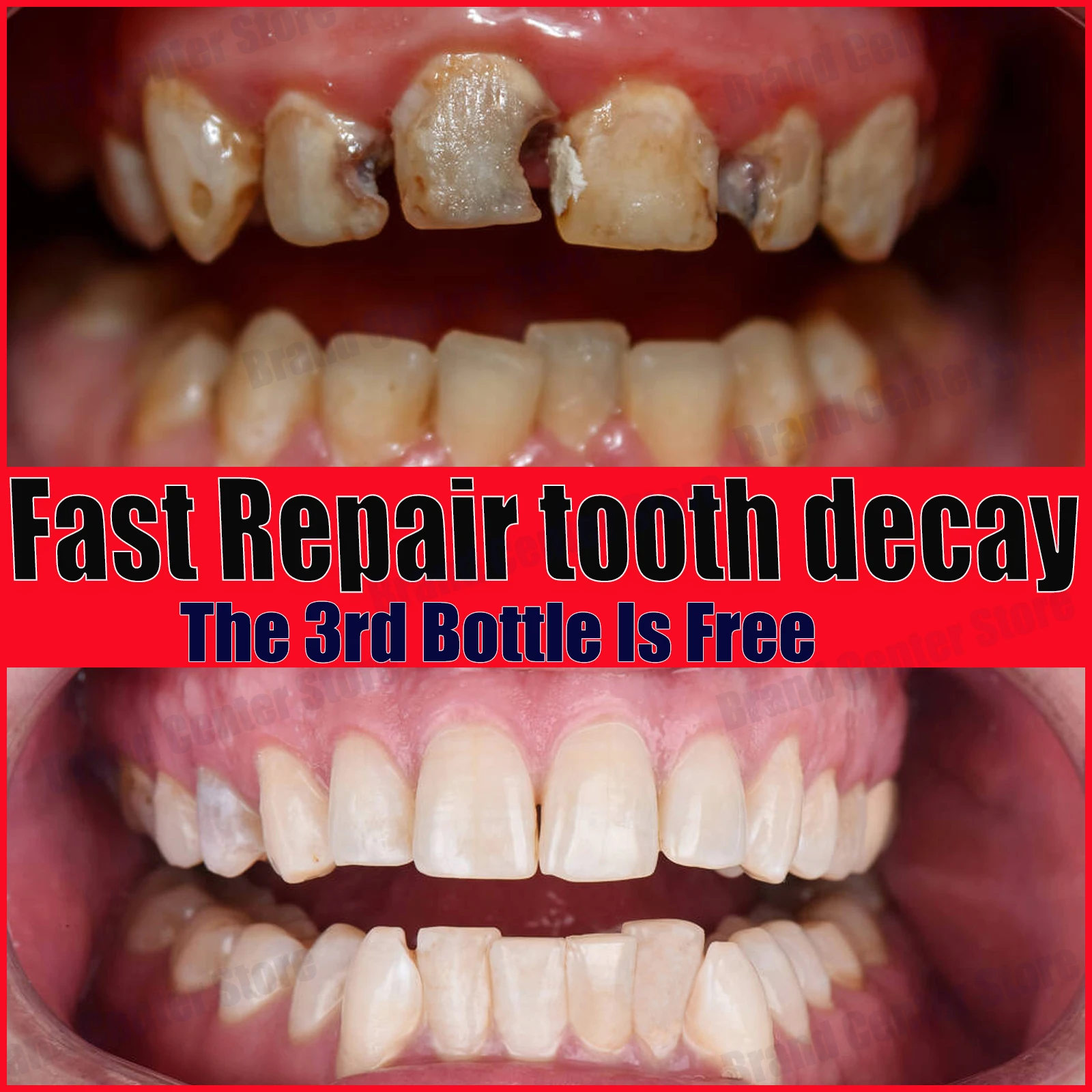 tooth decay repair cavities protect teeth